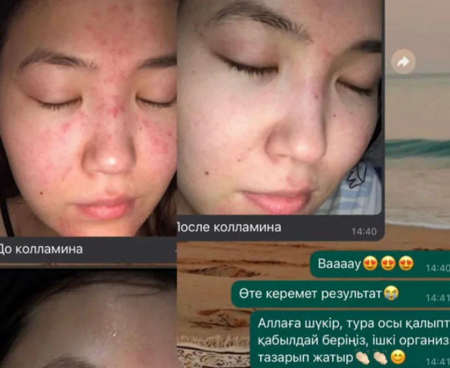 До и после: ногти